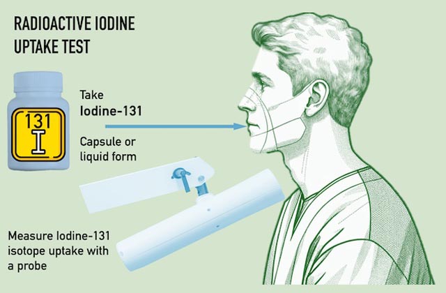 Diagram showing advanced diagnostic techniques for thyroid health, including imaging and biopsy procedures.